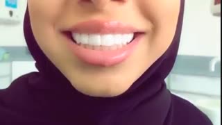جذابیت لبخند در چند ثانیه