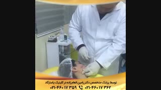 زاویه دار کردن صورت