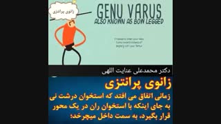 زانوی پرانتزی