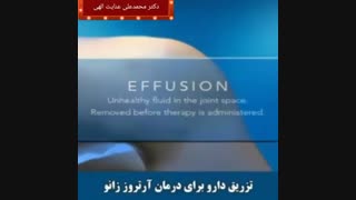 تزریق دارو برای درمان آرتروز زانو!!!