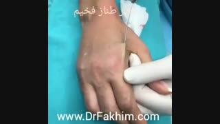 جوانسازی پوست دست