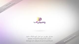 لیپوماتیک پیکرتراشی در مشهد