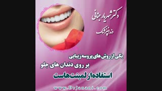 دندان هایتان را با لمینت زیباتر کنید