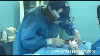 جراحی پروتز گونه توسط دکتر مسعود ناصری صدر بررسی لک صورت