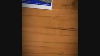 نمونه کار جراحی بینی دکتر مسعود ناصری صدر عصب‌کشی