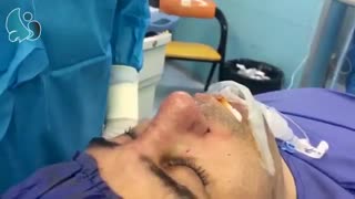 جراحی بینی توسط دکتر مسعود ناصری صدر لیپوست