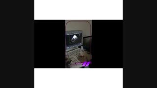 اکو کاردیو گرافی