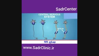 بیماری ms