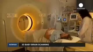اسکن سه بعدی مغز جنین