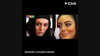 بازیگر زن ایرانی قبل و بعد از عمل زیبایی