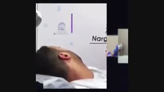 انجام میکرواسکالپ توسط خانم نرگس علیپور