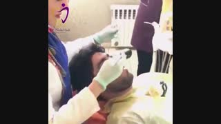بازسازی دندان های شکسته به وسیله روکش