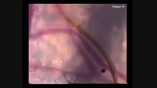نحوه پیدا کردن سرخرگ (مویرگ) توسط نیش پشه