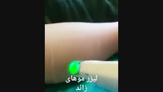 لیزر موهای زائد - کلینیک زیبایی پری سیما - 22807060