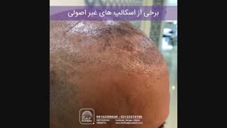 اسکالپ غیراصولی خطری در کمین شما