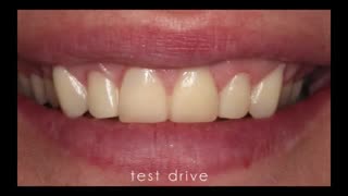 طراحی لبخند دیجیتال|کلینیک دندانپزشکی مدرن