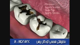 دندان ها چرا و چگونه خراب می شوند؟