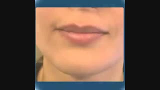 مراقبت های بعد از تزریق ژل