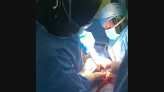 فیلم واقعی زایمان سزارین ؟!