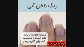 نشانه شناسی ناخن ها !!