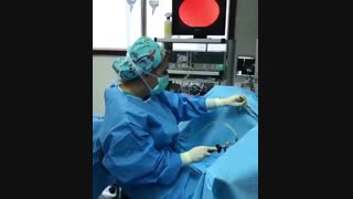 دو بار IVF انجام شده و حالا هیستروسکوپی