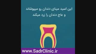 دلایل تغییر رنگ دندان ها