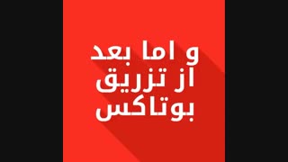 تزریق بوتاکس | دکتر مصطفی خدایاری
