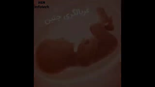 تست سرطان دهانه رحم