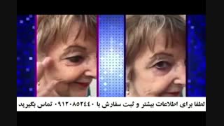 قیمت کرم ضد چروک فوری درمولند 09120852440 روکش دندان