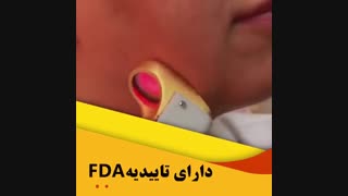 لیزر دائمی موهای زائد
