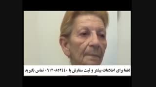 تست کرم ضد چروک فوری بر روی خانم 70 ساله 09120852440 کاشت ابرو