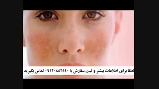 کرم ضد لک ملاسما یا ضد لک بارداری گیاهی 09120852440 برداشتن خال