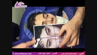 فیلم عمل بینی| دکتر کیوان کاوان ارتودنسی