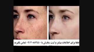 قیمت کرم ضد لک کک مک درمولند 5040-666-0902 ارسال رایگان ترمیم ونیر