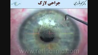 فیلم عمل لازک