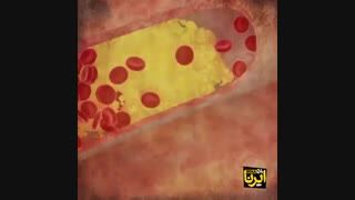 چقدر در معرض ابتلا به سرطان قرار داریم؟