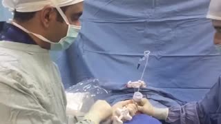 عمل جراحی کیفوپلاستی / دکتر مسعود اصغری نوسری