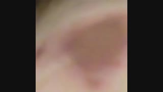 به نظرتون خوب میشه زخمه؟