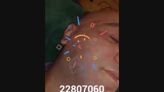 جوانسازی پوست صورت - کلینیک زیبایی پری سیما - 22807060 پروتز دندان