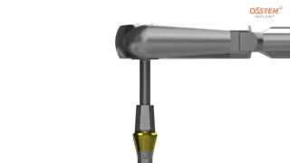 ایمپلنت | کلینیک دندانپزشکی تاج