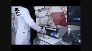 آشنایی با پلاسمای غنی از پلاکت (پی آرپی) در دردهای آرتروز و اسکلتی عضلانی