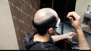 آموزش نصب پروتز مو در منزل توسط خود شخص /الگانت مو /02188962259