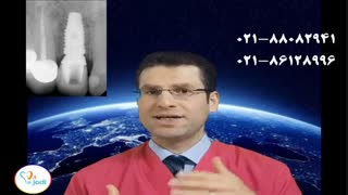 ایمپلنت لیزری - جراحی ایمپلنت با لیزر