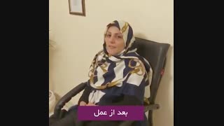 دو ماه بعد از جراحی بینی و رضایت بیمار