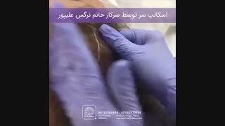 اسکالپ سر برای خانم ها
