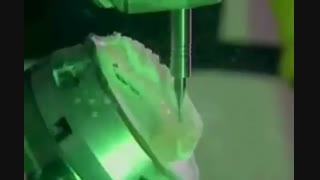 درمان ارتودنسی با پلاک شفاف|کلینیک دندانپزشکی مدرن