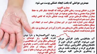 پیشگیری و درمان خشکی پوست