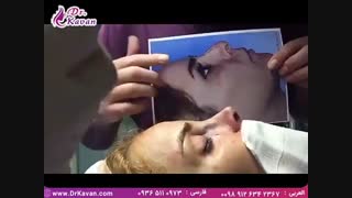 عمل بینی و برطرف کردن مشکل تنفسی