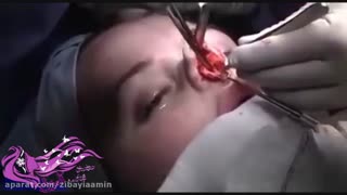 عمل زیبایی بینی