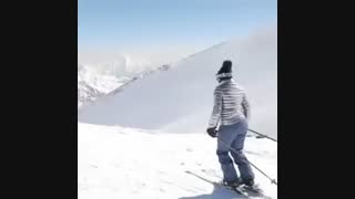 اسکى بازی بهاره افشارى دندان شیری